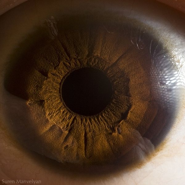 Extreme close-up of iris pigmentation by Suren Manvelyan