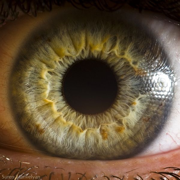 Close-up human eye showing iris crypts and fibers